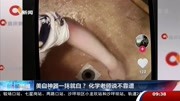 美白神器一抹就白?化学老师说不靠谱资讯搜索最新资讯爱奇艺