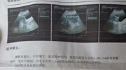 德州一女子未孕却被查出怀孕 手术后医院也“傻了”资讯搜索最新资讯爱奇艺