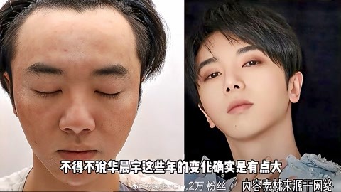 華晨宇被爆整容植髮,前女友發視頻稱張碧晨是小三,本人暫未回應